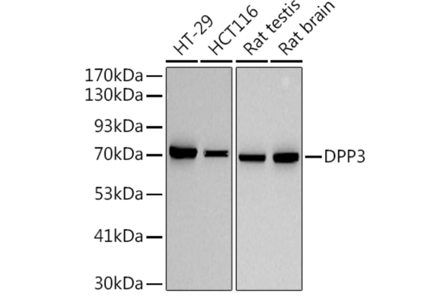 Western Blot - Anti-DPP3 Antibody [ARC2778] (A308406) - Antibodies.com