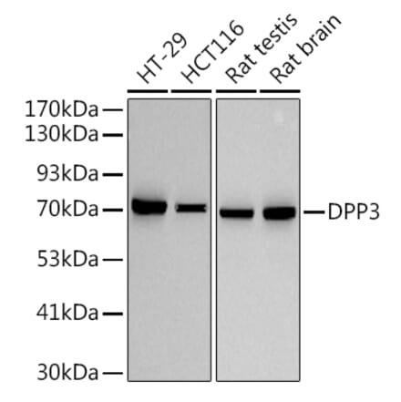 Western Blot - Anti-DPP3 Antibody [ARC2778] (A308406) - Antibodies.com