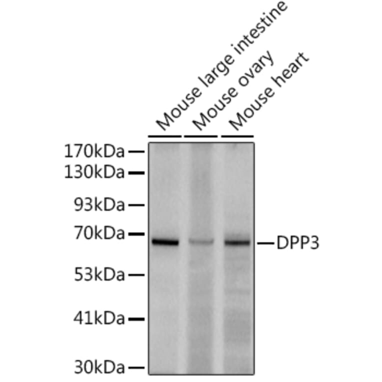 Western Blot - Anti-DPP3 Antibody [ARC2778] (A308406) - Antibodies.com