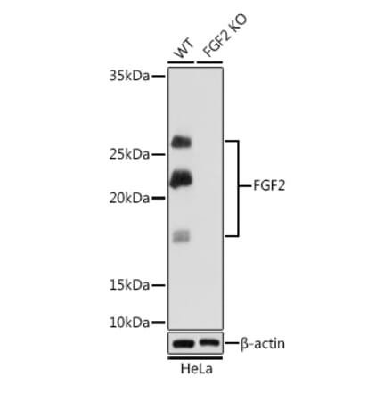 Western Blot - Anti-FGF2 Antibody [ARC0618] (A308407) - Antibodies.com