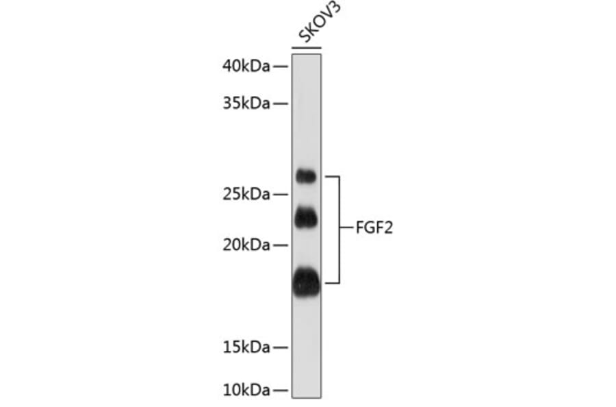 Western Blot - Anti-FGF2 Antibody [ARC0618] (A308407) - Antibodies.com