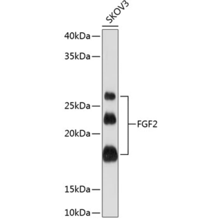 Western Blot - Anti-FGF2 Antibody [ARC0618] (A308407) - Antibodies.com