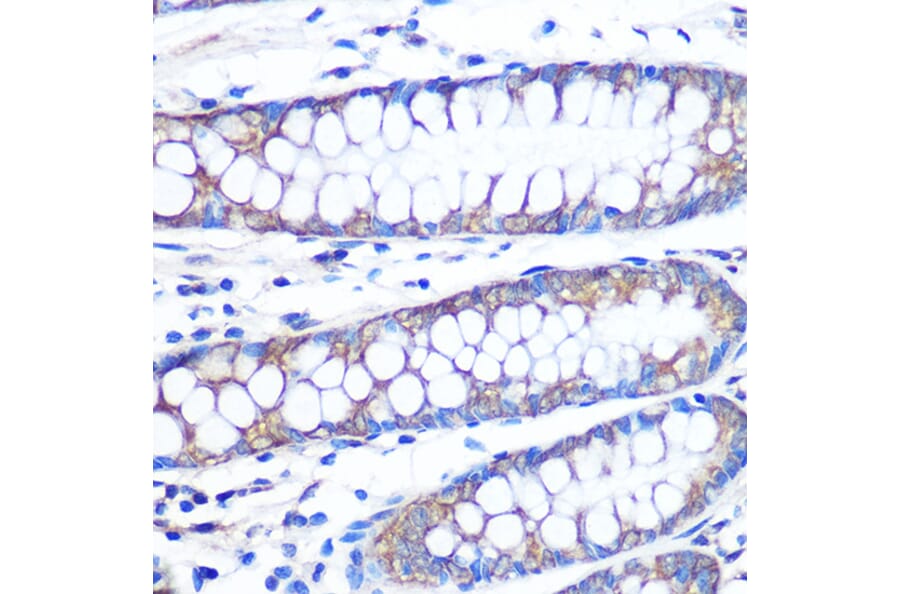 Immunohistochemistry - Anti-FGF2 Antibody [ARC0618] (A308407) - Antibodies.com