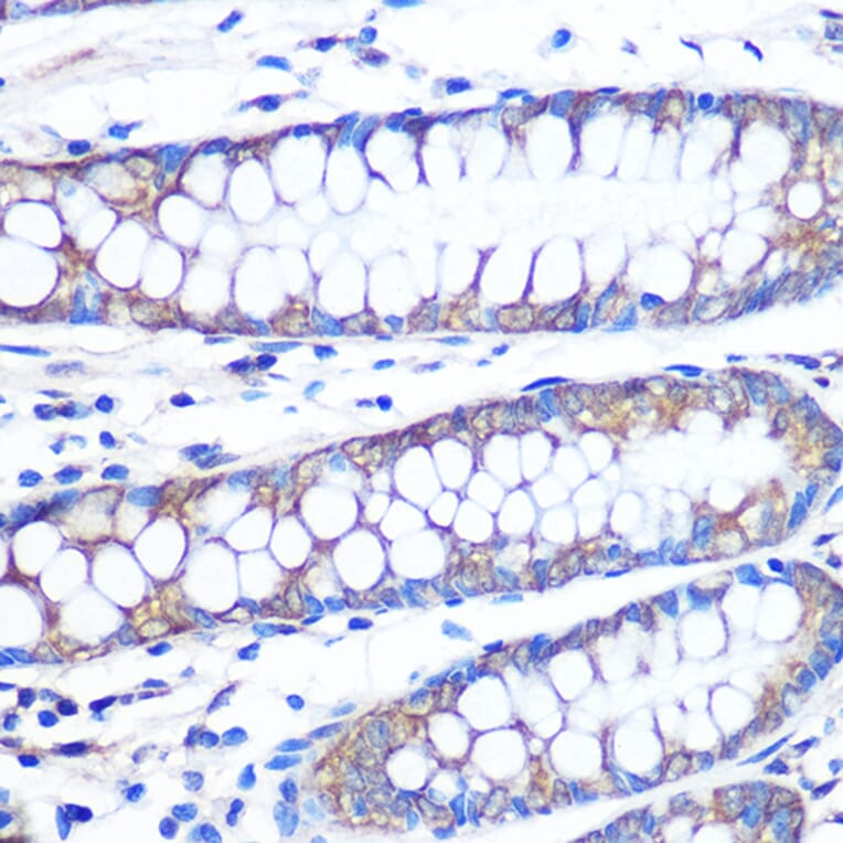 Immunohistochemistry - Anti-FGF2 Antibody [ARC0618] (A308407) - Antibodies.com