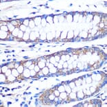 Immunohistochemistry - Anti-FGF2 Antibody [ARC0618] (A308407) - Antibodies.com