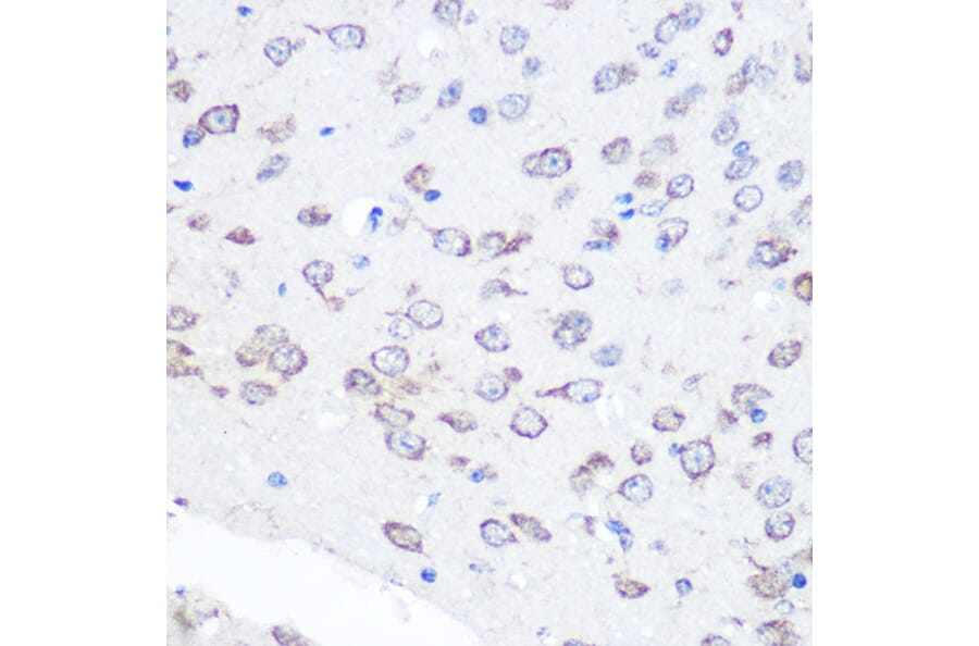 Immunohistochemistry - Anti-FGF2 Antibody [ARC0618] (A308407) - Antibodies.com