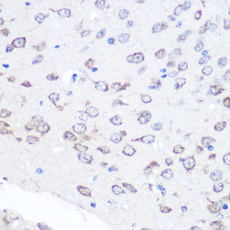 Immunohistochemistry - Anti-FGF2 Antibody [ARC0618] (A308407) - Antibodies.com