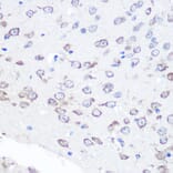 Immunohistochemistry - Anti-FGF2 Antibody [ARC0618] (A308407) - Antibodies.com