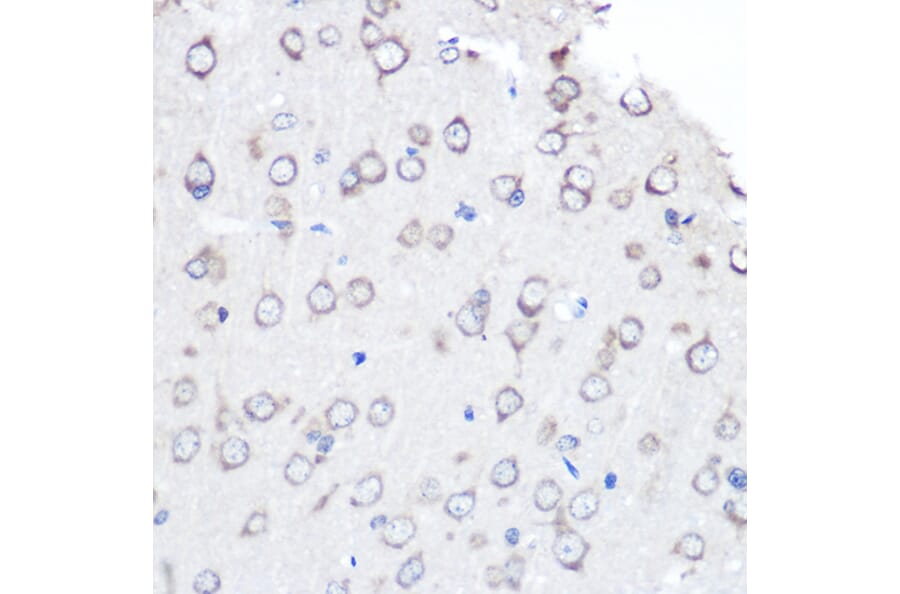 Immunohistochemistry - Anti-FGF2 Antibody [ARC0618] (A308407) - Antibodies.com