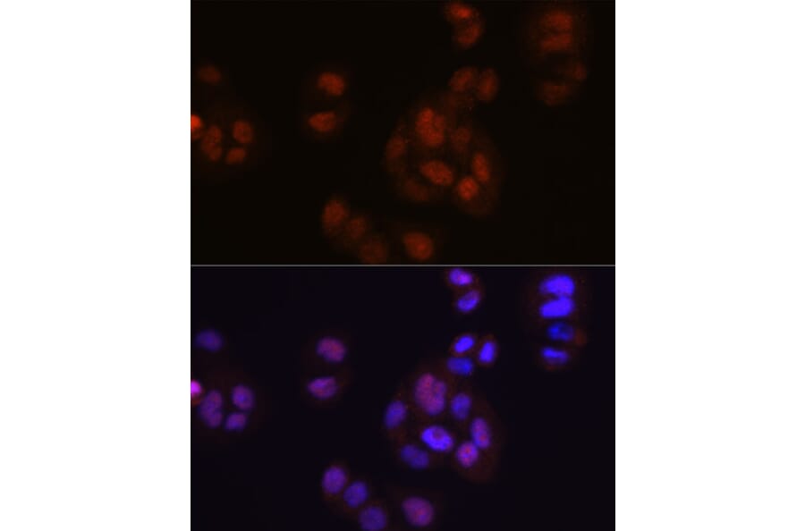 Immunofluorescence - Anti-FGF2 Antibody [ARC0618] (A308407) - Antibodies.com