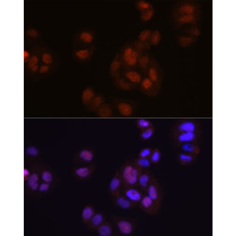 Immunofluorescence - Anti-FGF2 Antibody [ARC0618] (A308407) - Antibodies.com