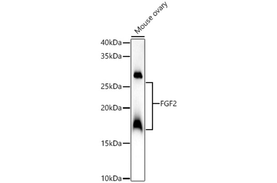 Western Blot - Anti-FGF2 Antibody (A308408) - Antibodies.com
