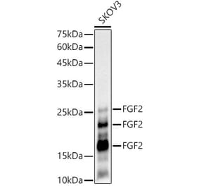 Western Blot - Anti-FGF2 Antibody [ARC51110] (A308409) - Antibodies.com