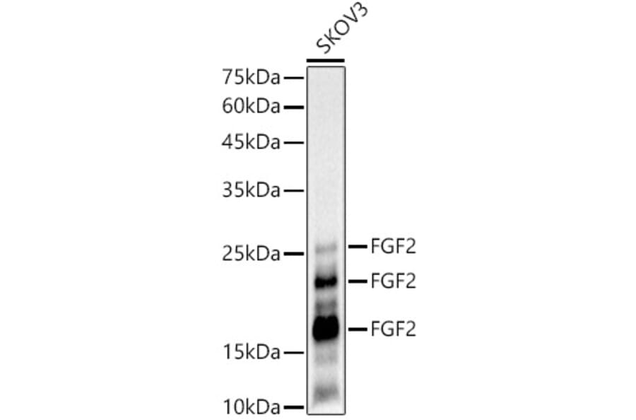 Western Blot - Anti-FGF2 Antibody [ARC51110] (A308409) - Antibodies.com