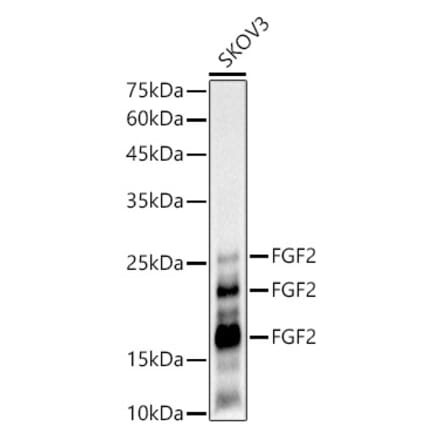 Western Blot - Anti-FGF2 Antibody [ARC51110] (A308409) - Antibodies.com
