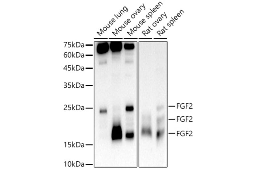 Western Blot - Anti-FGF2 Antibody [ARC51110] (A308409) - Antibodies.com
