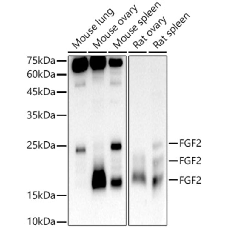 Western Blot - Anti-FGF2 Antibody [ARC51110] (A308409) - Antibodies.com