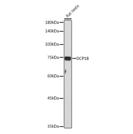 Western Blot - Anti-DCP1B Antibody (A308410) - Antibodies.com