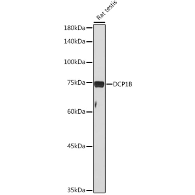 Western Blot - Anti-DCP1B Antibody (A308410) - Antibodies.com