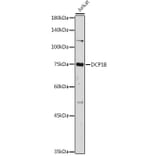 Western Blot - Anti-DCP1B Antibody (A308410) - Antibodies.com