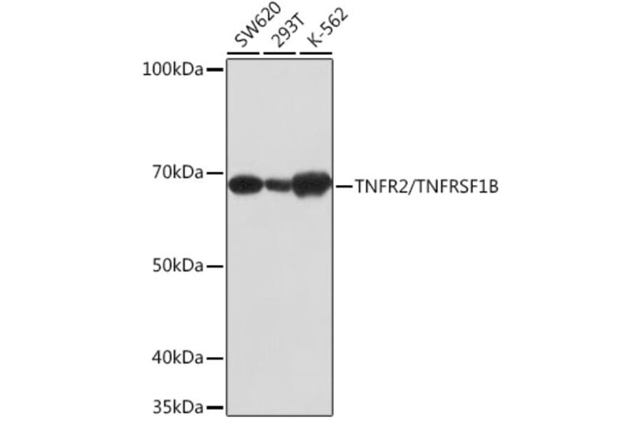 Western Blot - Anti-TNF Receptor II Antibody [ARC0397] (A308412) - Antibodies.com