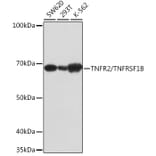 Western Blot - Anti-TNF Receptor II Antibody [ARC0397] (A308412) - Antibodies.com