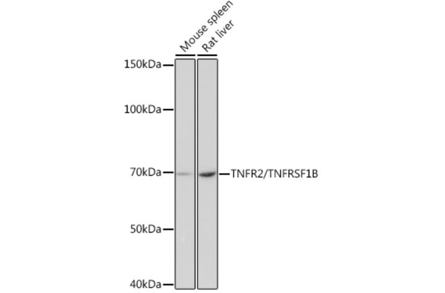 Western Blot - Anti-TNF Receptor II Antibody [ARC0397] (A308412) - Antibodies.com