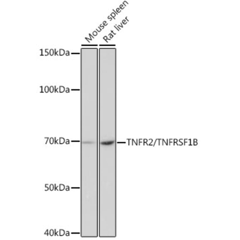 Western Blot - Anti-TNF Receptor II Antibody [ARC0397] (A308412) - Antibodies.com