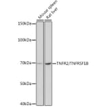 Western Blot - Anti-TNF Receptor II Antibody [ARC0397] (A308412) - Antibodies.com
