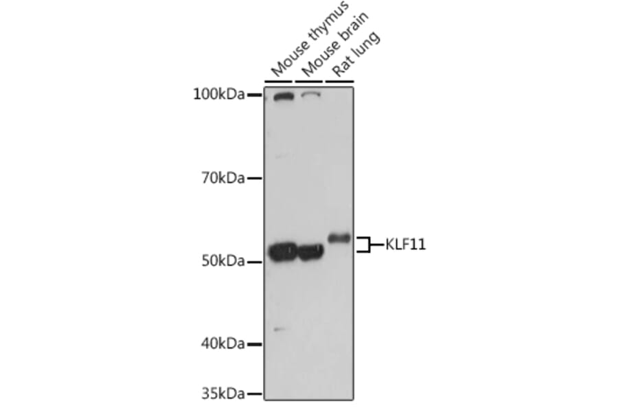 Western Blot - Anti-FKLF/KLF11 Antibody (A308413) - Antibodies.com