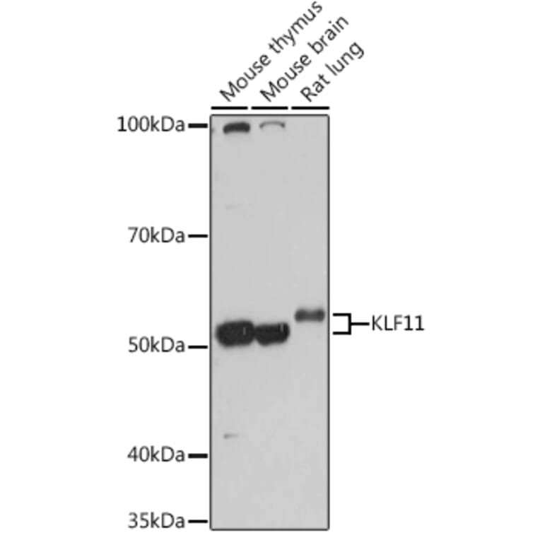Western Blot - Anti-FKLF/KLF11 Antibody (A308413) - Antibodies.com