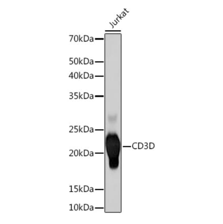 Western Blot - Anti-CD3D Antibody [ARC1741] (A308414) - Antibodies.com