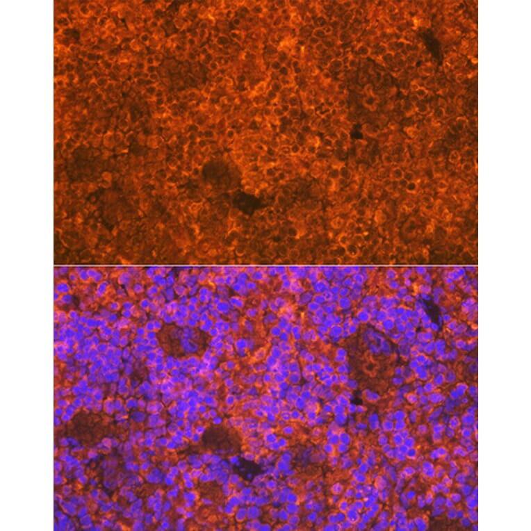 Immunofluorescence - Anti-CD3D Antibody [ARC1741] (A308414) - Antibodies.com