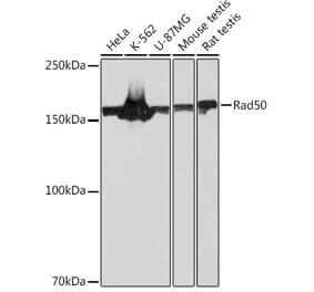 Western Blot - Anti-Rad50 Antibody [ARC0854] (A308415) - Antibodies.com