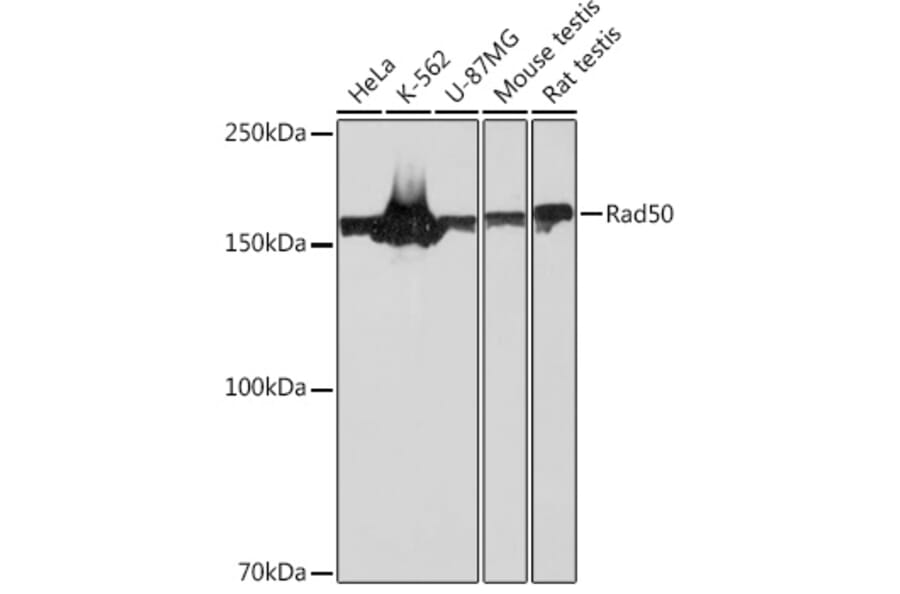 Western Blot - Anti-Rad50 Antibody [ARC0854] (A308415) - Antibodies.com