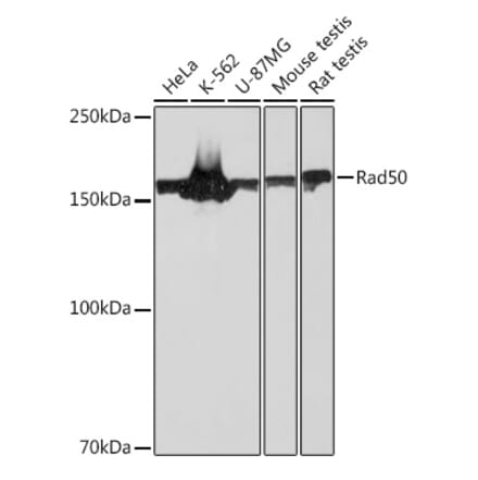 Western Blot - Anti-Rad50 Antibody [ARC0854] (A308415) - Antibodies.com