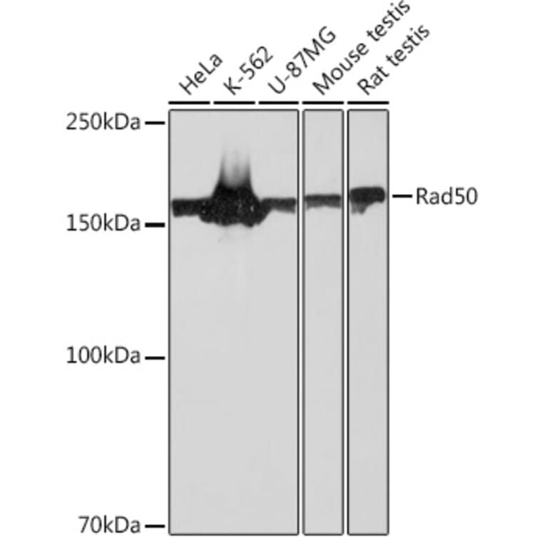 Western Blot - Anti-Rad50 Antibody [ARC0854] (A308415) - Antibodies.com