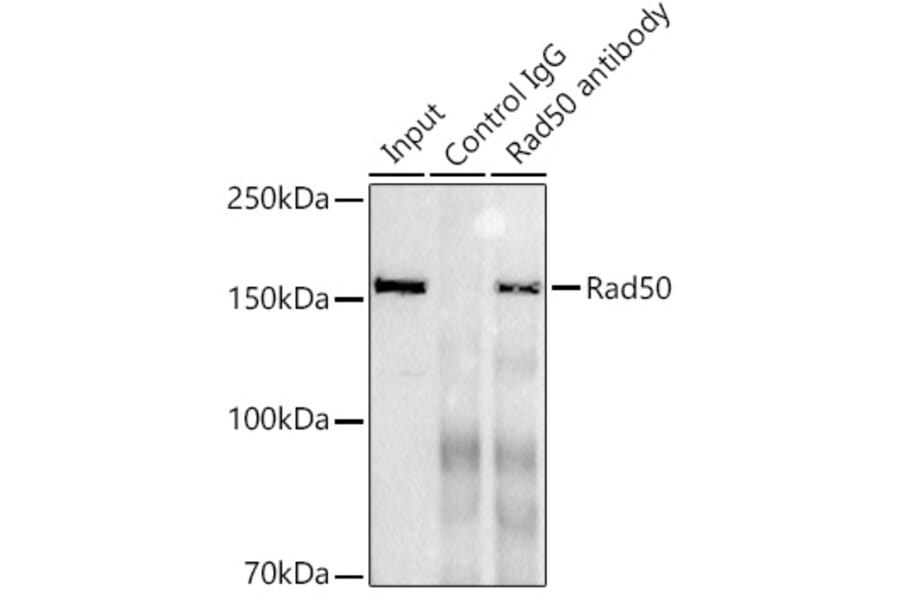 Western Blot - Anti-Rad50 Antibody [ARC0854] (A308415) - Antibodies.com