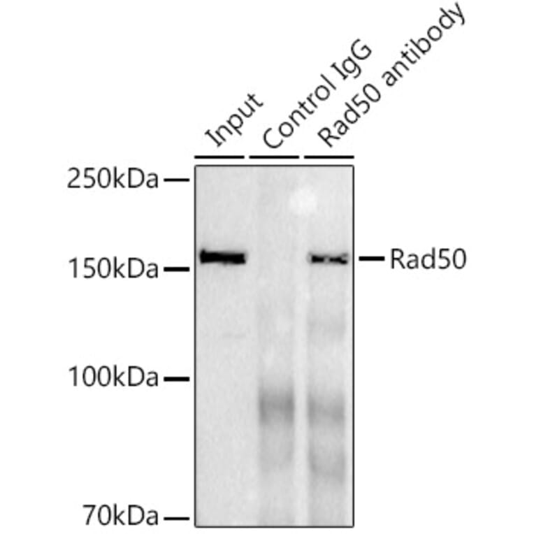Western Blot - Anti-Rad50 Antibody [ARC0854] (A308415) - Antibodies.com