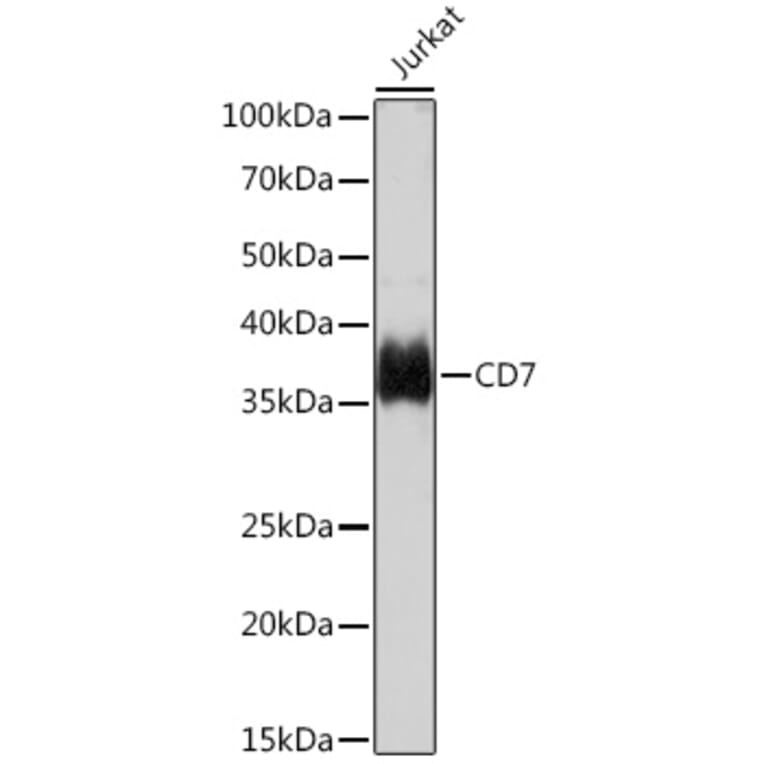 Western Blot - Anti-CD7 Antibody [ARC1634] (A308416) - Antibodies.com