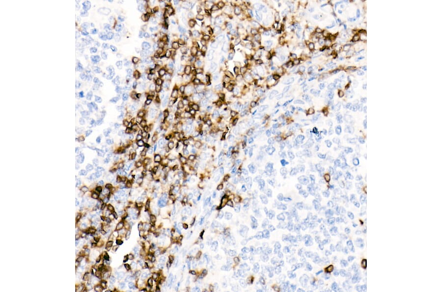Immunohistochemistry - Anti-CD7 Antibody [ARC1634] (A308416) - Antibodies.com