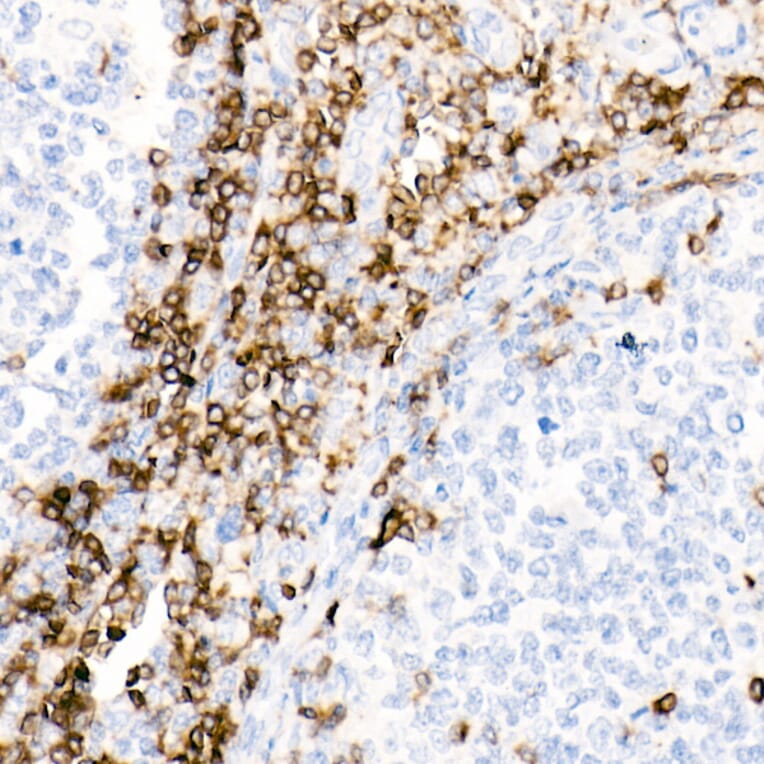 Immunohistochemistry - Anti-CD7 Antibody [ARC1634] (A308416) - Antibodies.com