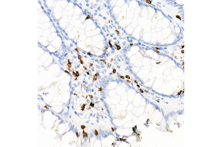 Immunohistochemistry - Anti-CD7 Antibody [ARC1634] (A308416) - Antibodies.com