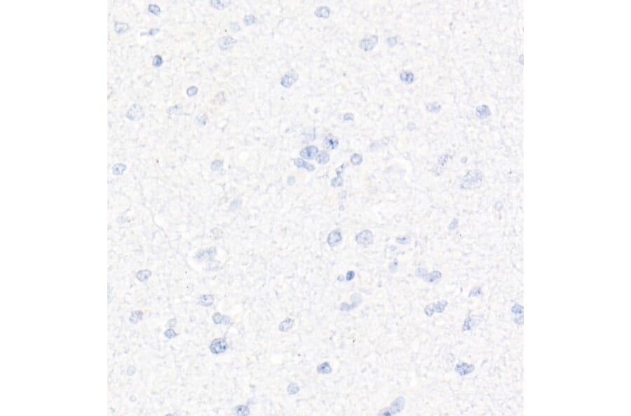 Immunohistochemistry - Anti-CD7 Antibody [ARC1634] (A308416) - Antibodies.com