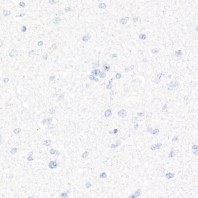 Immunohistochemistry - Anti-CD7 Antibody [ARC1634] (A308416) - Antibodies.com