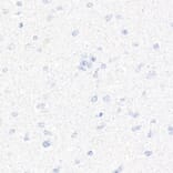 Immunohistochemistry - Anti-CD7 Antibody [ARC1634] (A308416) - Antibodies.com