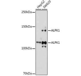 Western Blot - Anti-ALPK1 Antibody (A308417) - Antibodies.com