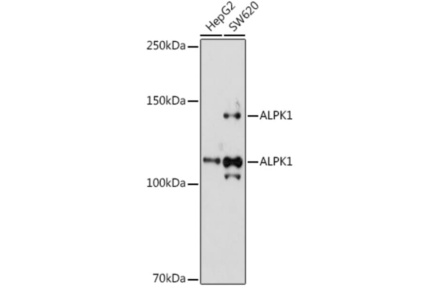Western Blot - Anti-ALPK1 Antibody (A308417) - Antibodies.com