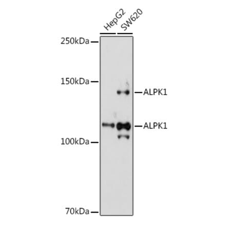 Western Blot - Anti-ALPK1 Antibody (A308417) - Antibodies.com