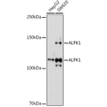 Western Blot - Anti-ALPK1 Antibody (A308417) - Antibodies.com